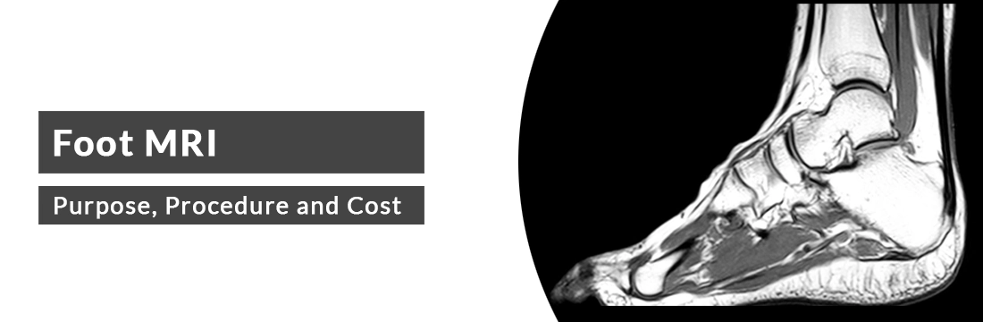 Foot MRI: Purpose, Procedure, Cost and Best MRI Centre